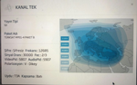 KANAL TEK Yayında