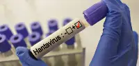 İstanbul'da Hantavirüs Karantinası